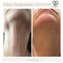 So Vein Therapies gallery photo 7